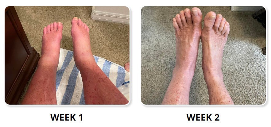 Does Native Krill Oil Really Work